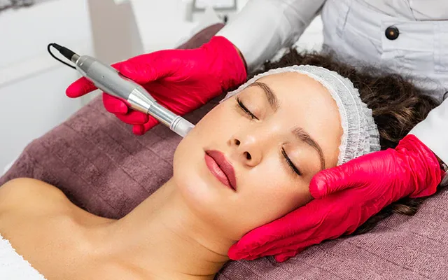 All About Microneedling